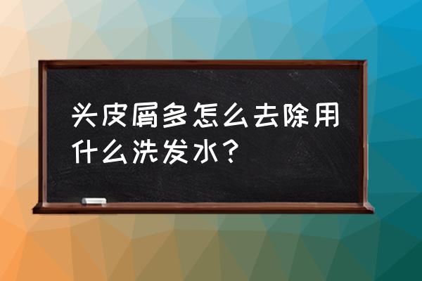 什么洗发精去头屑最好 头皮屑多怎么去除用什么洗发水？