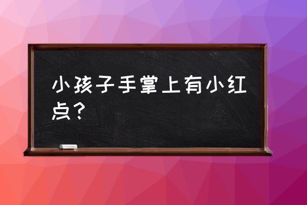 怎么判断儿童得水痘 小孩子手掌上有小红点？