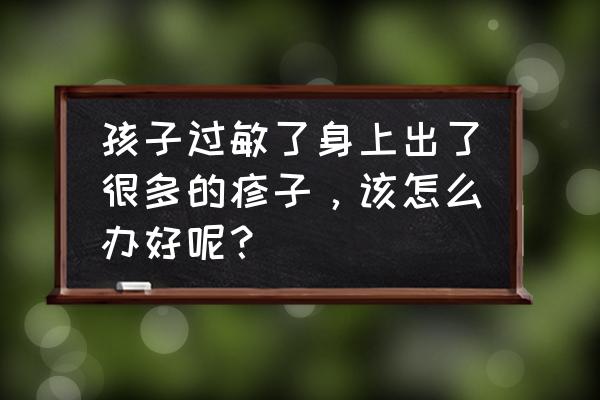 怎么防止宝宝过敏 孩子过敏了身上出了很多的疹子，该怎么办好呢？